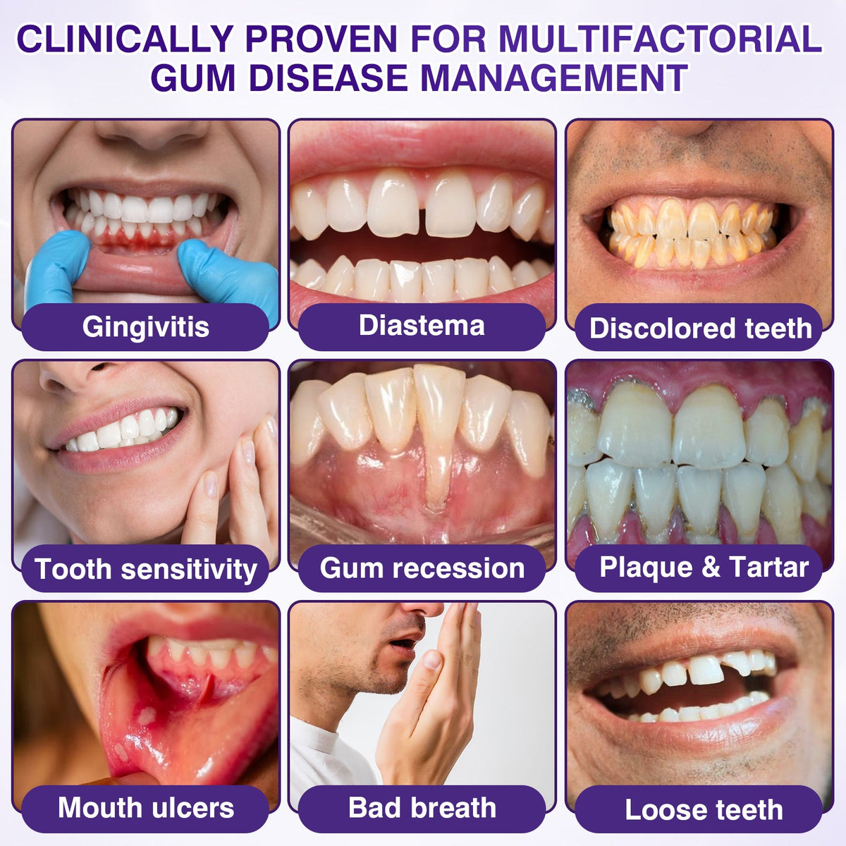 🇺🇸🎁🎁Evolvion® GumRevive Periodontal Repair Gel