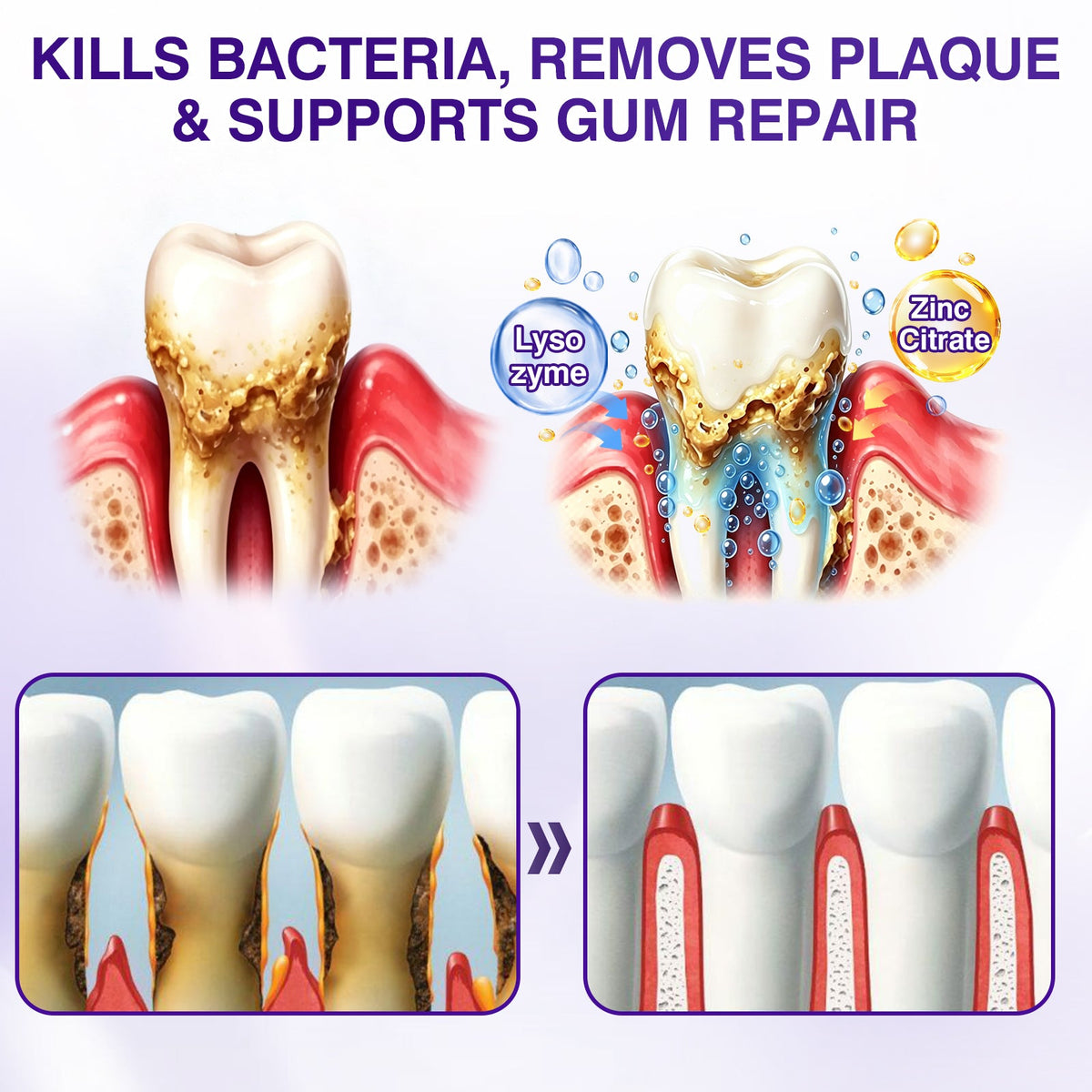 🇺🇸🎁🎁Evolvion® GumRevive Periodontal Repair Gel
