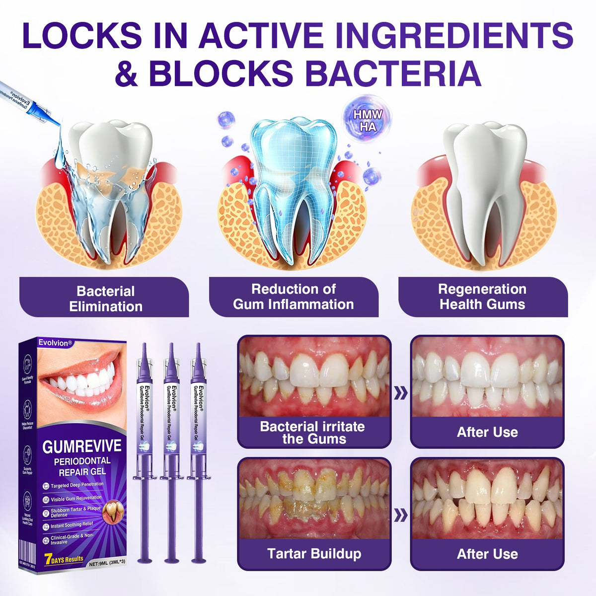 🇺🇸🎁🎁Evolvion® GumRevive Periodontal Repair Gel